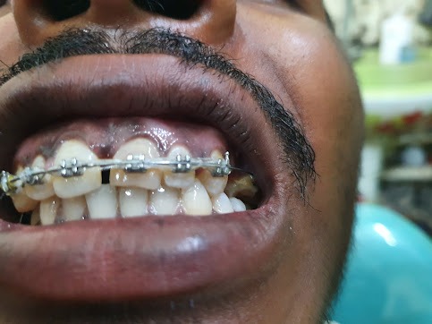 Modern Dental Operatory Room at Prasad Dental Care And Orthodontic Centre Jamshedpur